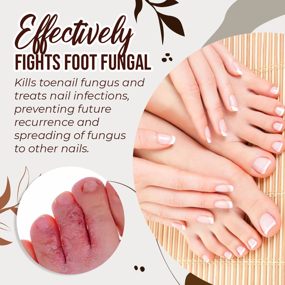 Hot Sale - Anti-Fungal Treatment Spray