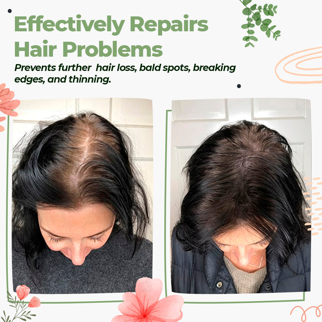 Green Ginger Hair Regrowth Spray