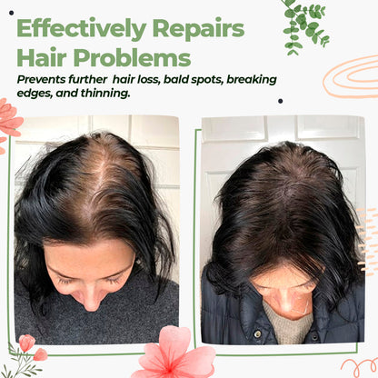 Green Ginger Hair Regrowth Spray