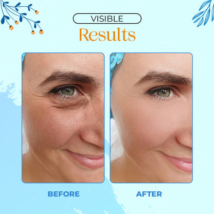 Botox Facial Anti-aging Serum