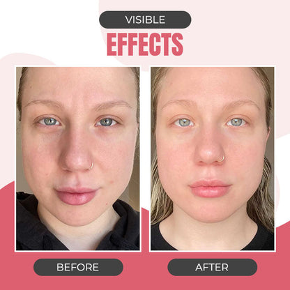 Advanced Skincare Wand with Red Light Therapy