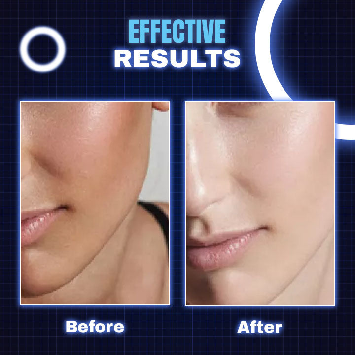 LED Light Theraphy Beauty Face Mask