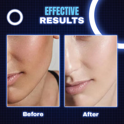 LED Light Theraphy Beauty Face Mask