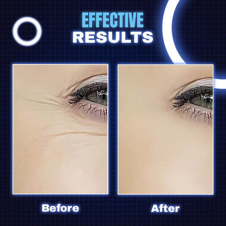 LED Light Theraphy Beauty Face Mask