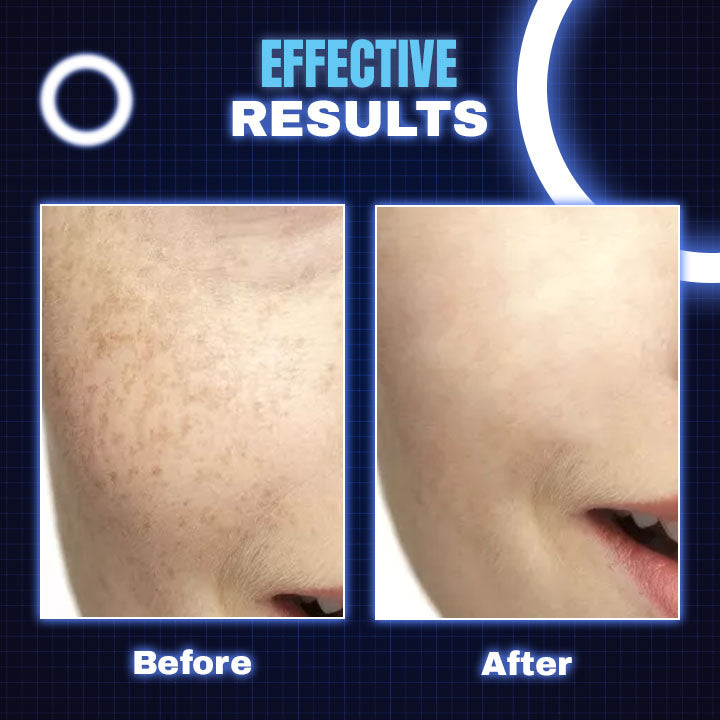 LED Light Theraphy Beauty Face Mask