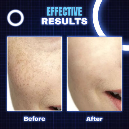 LED Light Theraphy Beauty Face Mask