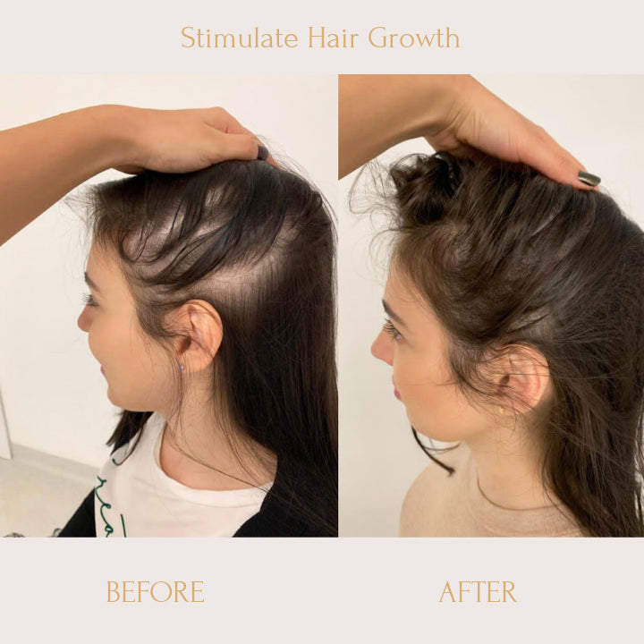 RegrowPlus Rice Water Serum