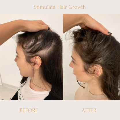 RegrowPlus Rice Water Serum