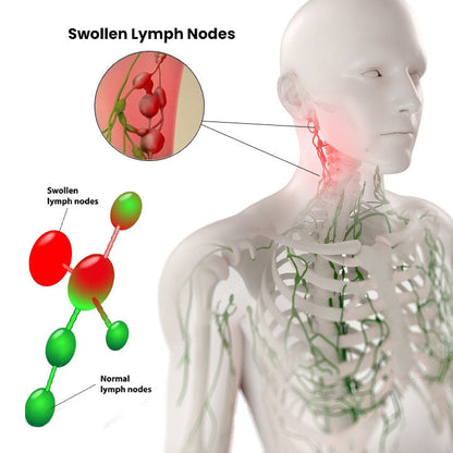 Lymphatic Drainage Herbal Shower Gel