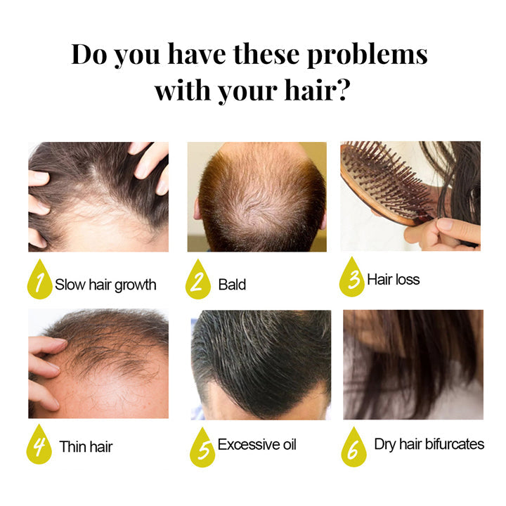 Shouga Kingu Hair Growth Oil
