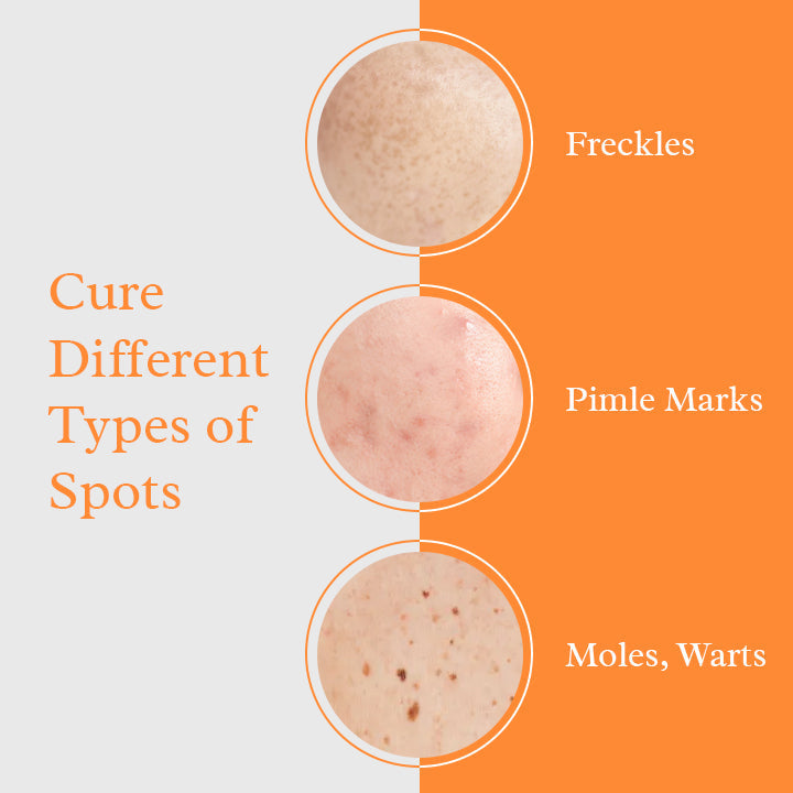 TruSkin Blemish Remover Serum
