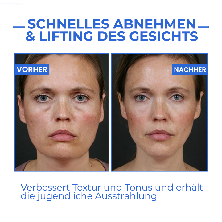 Youthfully™ Botox Gesichtsserum